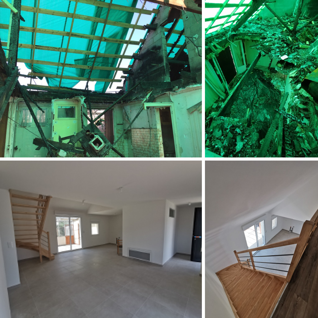 Reconstruction totale